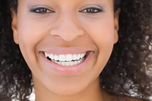 Beautiful smiling woman showing cosmetic dentistry results