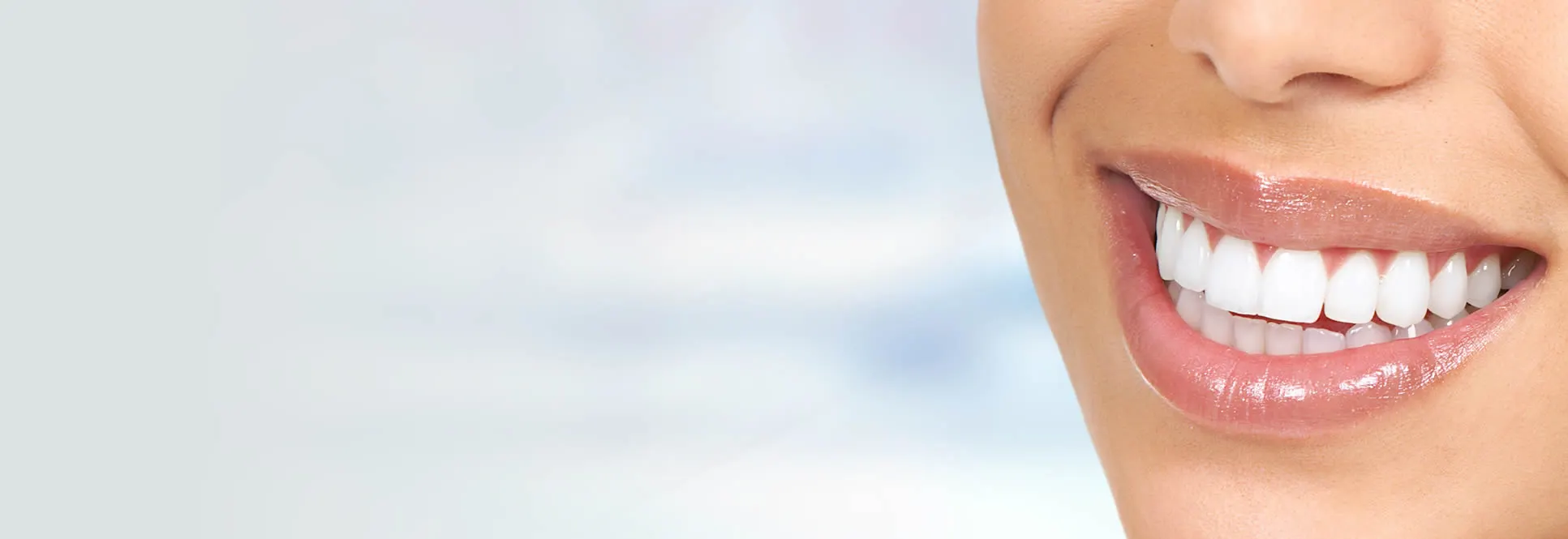 Beautiful straight smile achieved with Reveal clear aligners