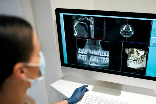 Digital dental x-rays taken during new patient exam at Roam Dental