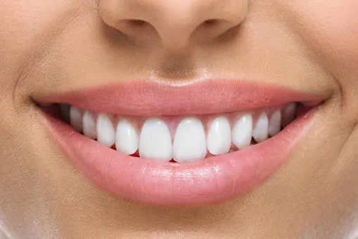 Patient with a perfect, confident smile after Roam Dental smile makeover