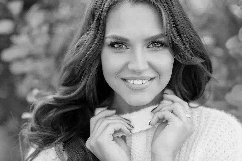 Beautiful smile makeover result at Roam Dental Shelby Township